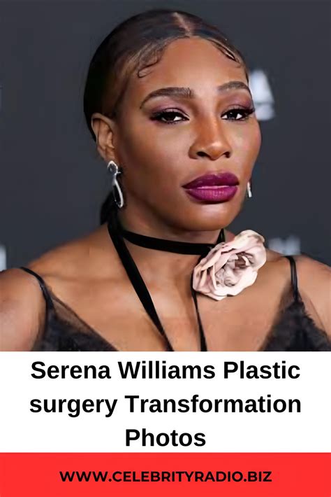 Serena Williams plastic surgery Transformation photos | Serena williams