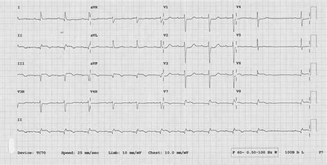 16 Best U Sndon Images On Pholder Earth Porn EK Gs And Itookapicture