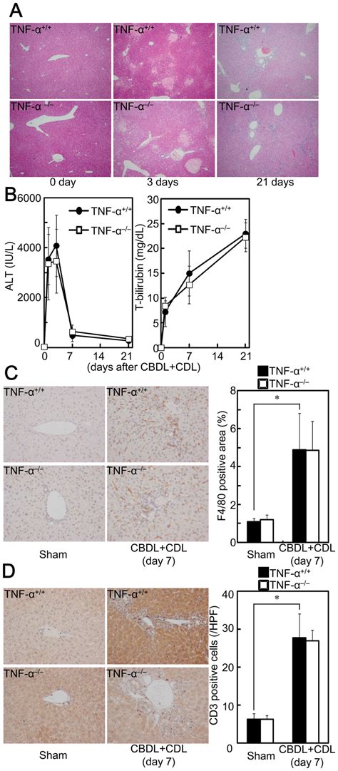 Tnf α Deficiency Did Not Affect Cbdlcdl Induced Liver Injury Tnf α