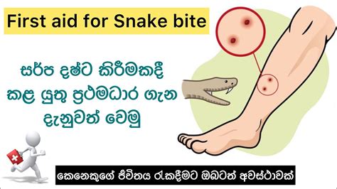 සර්ප දෂ්ට කිරීමක දී කළ යුතු ප්‍රථමාධාර⛑ First Aid For Snake Bite🐍