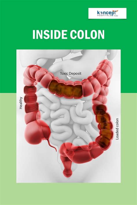 Colon Therapy Koncept Hospitals And Wellness