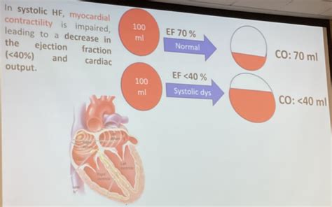 Cardio Exam 4 In Progress Flashcards Quizlet