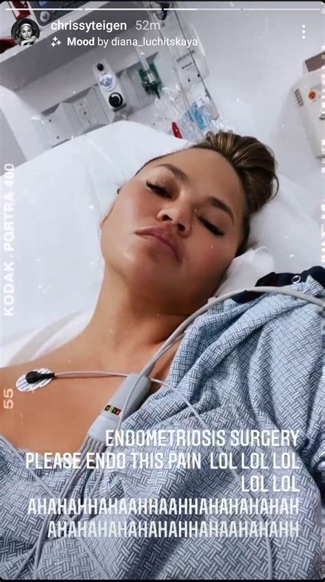 Chrissy Teigen Details Her Endometriosis Surgery And Recuperation