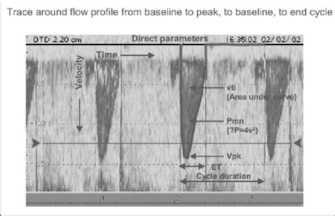 Showing A Typical Velocity Time Integral Curve Download Scientific Diagram