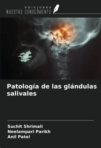 Patolog A De Las Gl Ndulas Salivales By Suchit Shrimali Goodreads