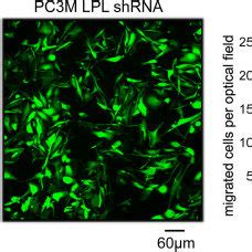 L Plastin Knock Down Reduces Cancer Cell Migration In Vitro Sdf