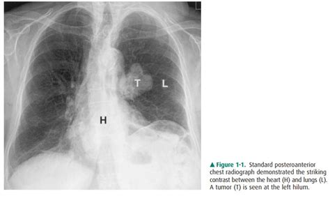 Conventional Radiography