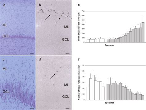 Reelin Mrna Expression In A Representative Sam Ple Of A Human Control