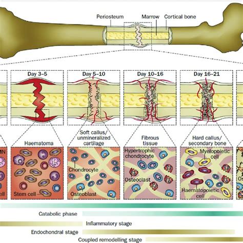 Describe the Process of Bone Healing - PeytonkruwSchmitt