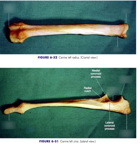 As Unit Radius And Ulna Diagram Appendicular Skeleton Diagram