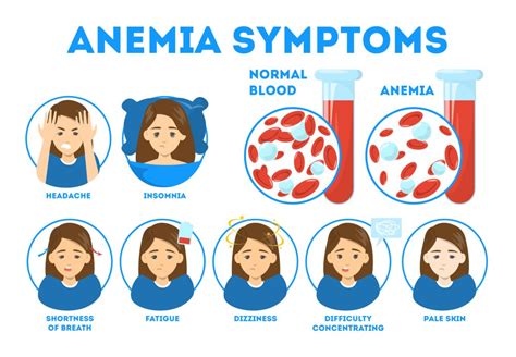 Anemia During Pregnancy Symptoms Risks Prevention