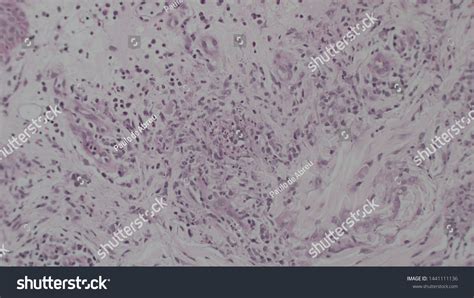 Microscopy Cytopathology Slides Histopathology Slides Cytopathology ...