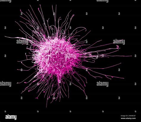 Cervical Cancer Cell SEM Stock Photo Alamy