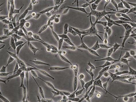 Mc Murine Colon Adenocarcinoma Cell Line Scc