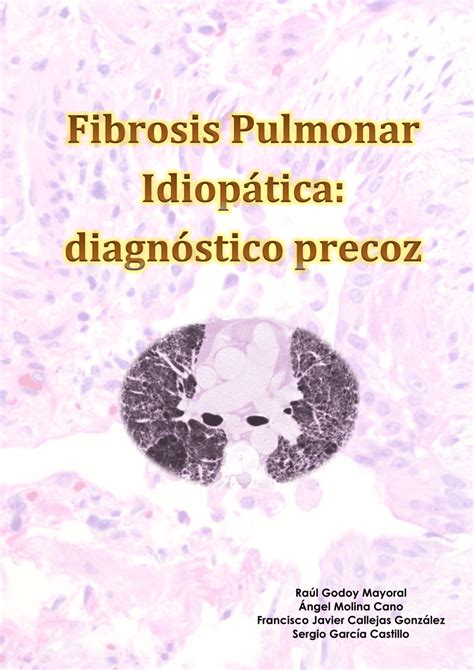 Pdf Fibrosis Pulmonar Idiop Tica Diagn Stico Precoz