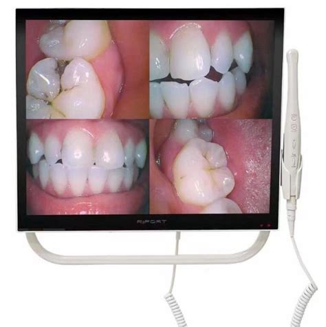 17 Inch Dental Monitor With Intraoral Camera For Dental Chair WiFi