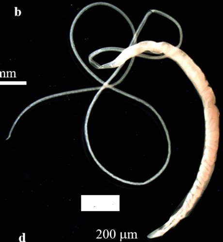 Nematodes Acanthocephala Flashcards Quizlet