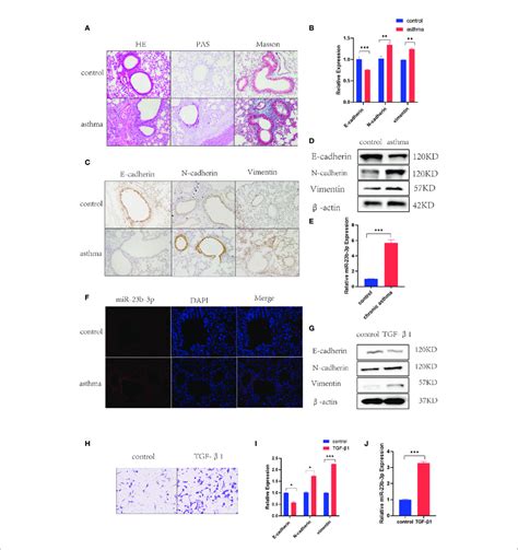 Chronic Asthmatic Mice Showed Emt And Increased Mir B P In