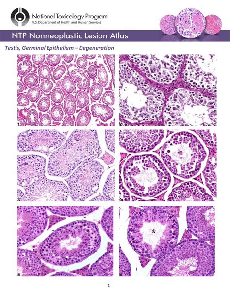 Pdf Testis Germinal Epithelium Degeneration · Figure 4 Testis Germinal Epithelium