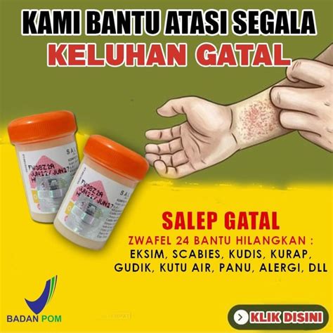 Jual Salep Zwafel Original Obat Gatal Panu Kadas Kurap Kutu Air