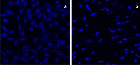 Morphological Alterations In Mcf 7 Cells Stained With Dapi After Download Scientific Diagram