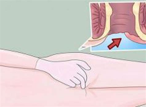 EARLY WARNING SIGNS OF ANAL CANCER EVERYONE IS TOO EMBARRASSED TO TALK ABOUT