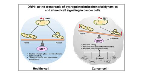 DRP1 At The Crossroads Of Dysregulated Mitochondrial Dynamics And