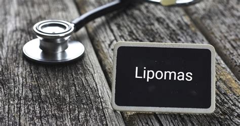 Lipoma: Causes, Symptoms, and Natural Treatments - Facty Health