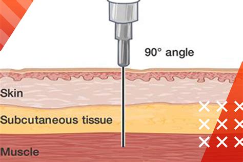 How To Inject Steroids 101 Easy Practical Guide With Explanations