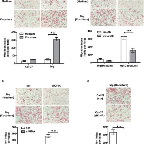 Kif4a Ccl2 Modulated Macrophages Function The Transcription Of Typical Download Scientific