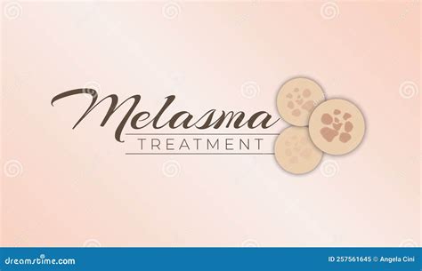 Melasma Treatment Banner Background Vector Design | CartoonDealer.com ...