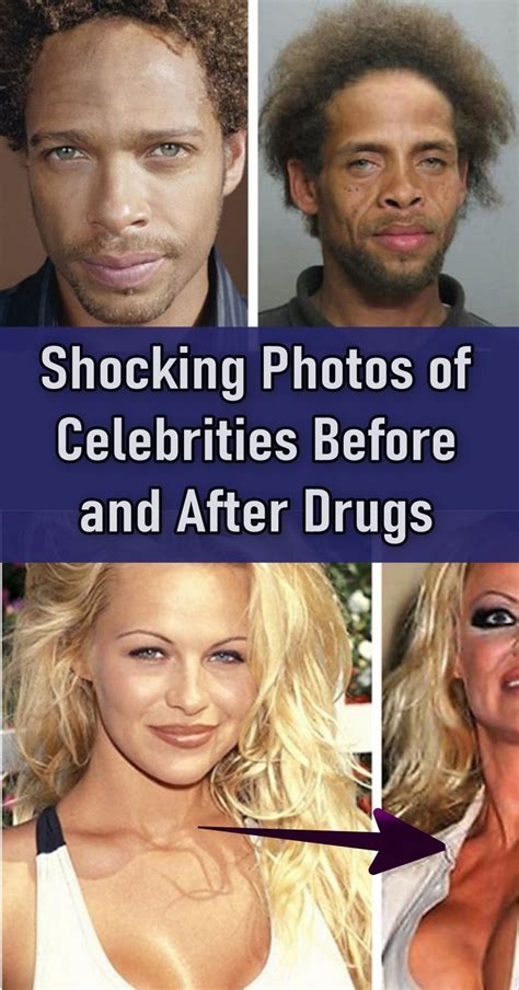 Shocking photos of celebrities before and after drugs – Artofit