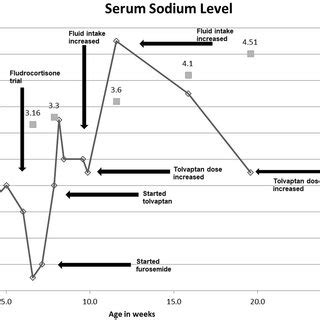 Serum Sodium Levels And Weight Of The Patient As A Function Of Time