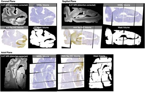 Histological Reconstructions Example Reconstruction For A Single