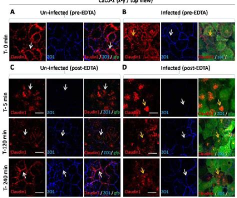 Figure 2 from Pathogenic mechanisms in microvillus inclusion disease ...