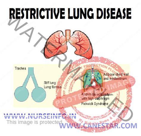 Restrictive Lung Diseases Nurse Info