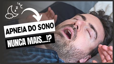 Apneia Do Sono Tem Cura Veja O Que Quais Os Sintomas E Como