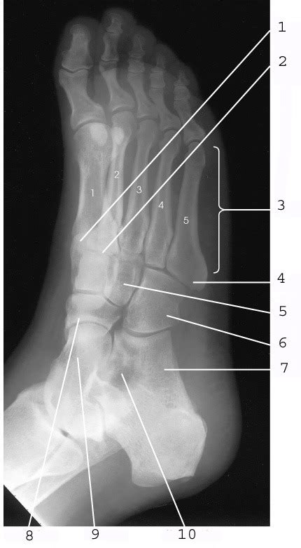 AP Oblique Foot Medial Rotation Diagram Quizlet