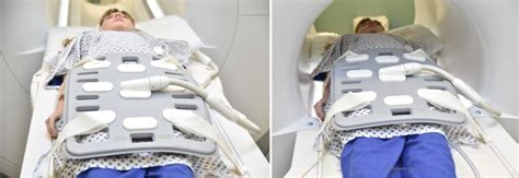 MRI Thigh Two-Station Automatic Composing Protocol and planning