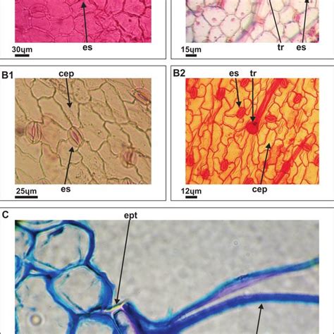 Fotomicrograf As De Epidermis En Vista Superficial A L Albus B L