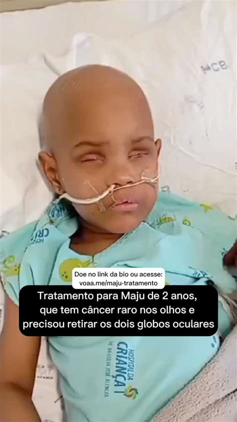 Maju tem apenas 2 anos e enfrenta uma doença chamada retinoblastoma