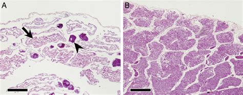 Light Micrographs Of Gonadal Tissue In The Female And Male Ariosoma