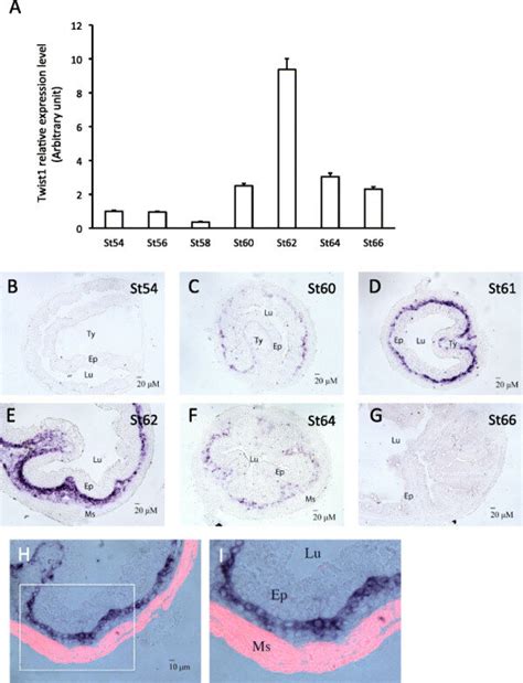 Twist Has Similar Spatiotemporal Expression Profiles As Snai In The