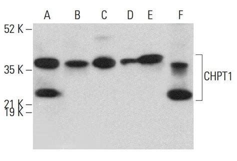 Chpt1抗体 F 7 Scbt Santa Cruz Biotechnology