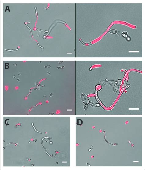 Both C Dubliniensis And C Tropicalis Adhere To C Albicans Hyphae