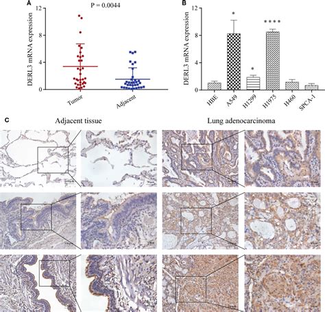 Frontiers Integrated Profiling Of Endoplasmic Reticulum Stress