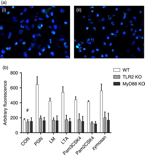 Agingrelated Atg Defect Impairs Neutrophil Extracellular Traps