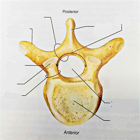 Typical vertebra Diagram | Quizlet