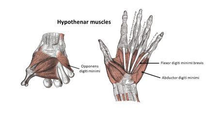 Which of the following intrinsic muscles is not associated with the ...