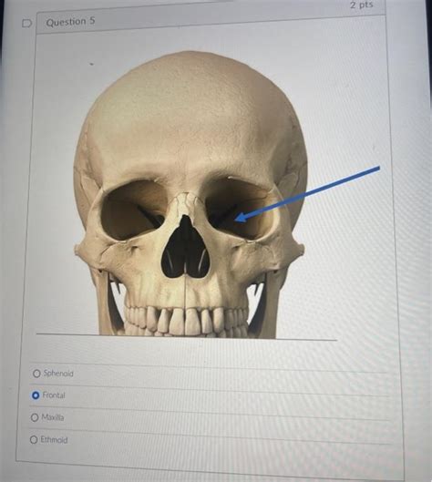 Solved Maxilla Temporal Sphingid Vomer Ethmoid Sphenoid